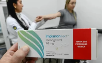 Ministério da Saúde qualifica 11 mil profissionais para oferta de implante contraceptivo no SUS