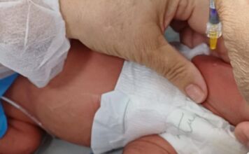 Mato Grosso disponibiliza imunização contra VSR para bebês prematuros